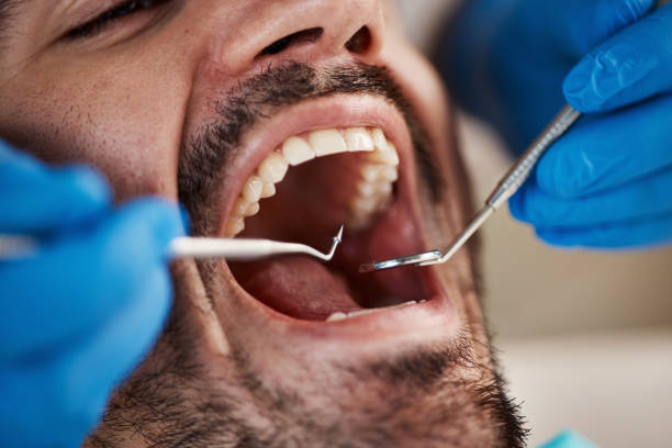 Best Pediatric Emergency Dentist in Frazeysburg, OH